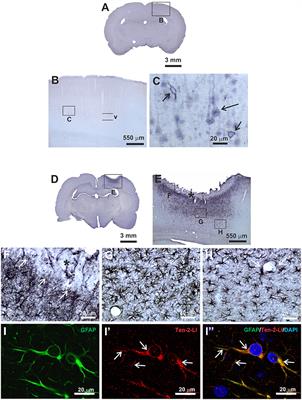 A Putative Role of Teneurin-2 and Its Related Proteins in Astrocytes